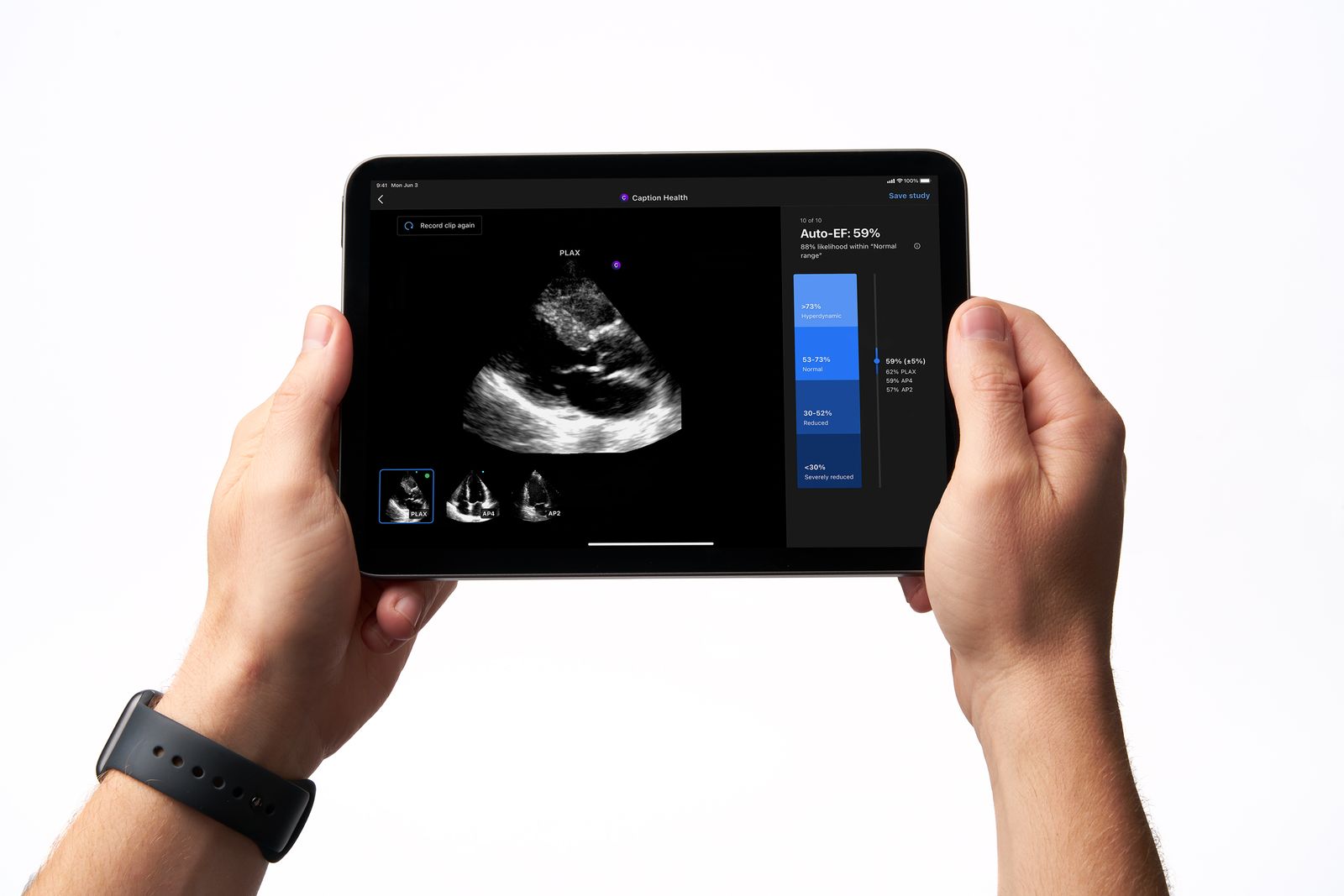 caption health GE healthcare echo ultrasound AI