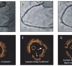  (OCT) intravascular images (bottom).