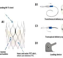 A team in China treated 10 patients—split evenly between men and women—with the SinoCrown TAVR valve developed by Lepu Medical Technology Company. The average patient age was 77.5 years old.