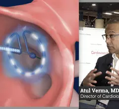 Atul Verma explains thne results of the PULSE-AF trial at ACC23.