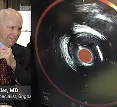 James Muller MD discusses vulnerable plaque and nuclear weapons as recipient of ACC Distinguished Scientist award. The right image in the near infrared spectroscopy system he developed to find vulnerable plaques.