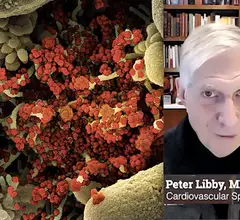 Peter Libby, MD, explains how infections cause heart attacks. This came out of research taking a close look at COVID, but the inflammation from any infection may cause increased inflammation of coronary plaques that cause heart attacks. #COVID #COVID19