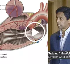 Video of Hari Naidu, MD, director of the Hypertrophic Cardiomyopathy Center of Excellence at Westchester Medical Center, explaining the role of alcohol septal ablation and surgical myectomy in the era of mavacamten. #HCM #ASE