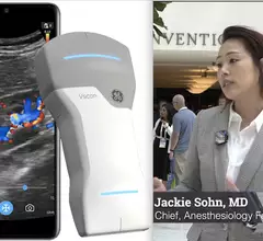 Jackie Sohn, DO, explains the use and trating requirements for intensivists and anesthesiologists to train on using point of care ultrasound (POCUS) at ASE 2023.