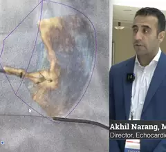 Akhil Narang, MD, director of the echocardiography laboratory at Northwestern Medicine explains the latest trends in structural heart interventional imaging. #ASE #ASE23 #ASE2023 #structuralheart #echofirst 