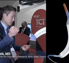 Robert Yeh, MD, explains the details of the AGENT IDE trial clinical trial results for the Agent drug-coated balloon vs plain angioplasty for in-stent restenosis at TCT 2023. #TCT #TCT2023 #DCB