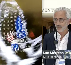 Luc Mertens, MD, section head of echocardiography at The Hospital for Sick Children in Toronto, explains application of ultrafast ultrasound and blood speckle imaging in echocardiography