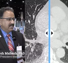 Video of Mahadevappa Mahesh, PhD, incoming-AAPM president, professor of radiology and a medical physicist, Johns Hopkins University School of Medicine, explains key trends in imaging physics presented at the Radiological Society of North America (RSNA) 2023 meeting. 