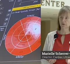 Marielle Scherrer-Crosbie, MD, Hospital of the University of Pennsylvania, discusses the latest trends in cardiac strain echo.