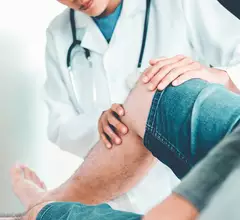 doctor looking at CLTI patient's leg