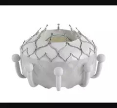 FDA approved the first transcatheter tricuspid valve (TTVR) replacement device in February 2024, the EVOQUE system from Edwards Lifesciences. The Evoque is the first transcatheter tricuspid valve approved by the FDA. The Evoke the first transcatheter tricuspid cleared in the United States.