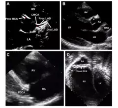 transthoracic echocardiogram images from 2024 ASE guidelines