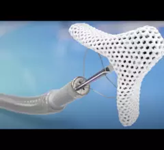An FDA panel will discuss its recommendations related to Abbott's TriClip G4 transcatheter edge-to-edge repair (TEER) system for tricuspid regurgitation.