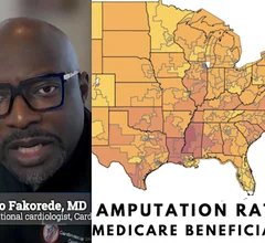 Foluso Fakorede, MD, interventional cardiologist, Cardiovascular Solutions of Central Mississippi, explains how he moved to rural Mississippi, the epicenter of the PAD and CLI epidemic, to open a practice to take action and reverse the glaring health disparities and that are leading to more than 400 leg amputations per day in the U.S.