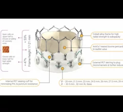 Meril Life Sciences, an India-based medical device company founded in 2006, developed the Myval TAVR valve