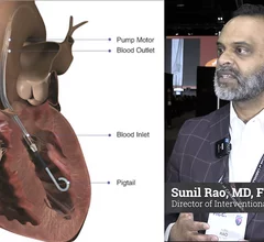 Sunil Rao, MD, NYU, explains the DANGER-SHOCK trial at ACC 2024 and how it may help improve cardiogenic shock survival. 