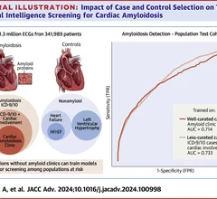 The central illustration from a study that shows the impact of ECG AI algorithm study case and control selection to train artificial intelligence to better screening patients for cardiac amyloidosis. Image courtesy of JACC Advances.