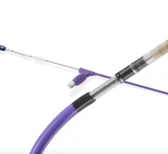 Boston Scientific has received U.S. Food and Drug Administration (FDA) approval for its INGEVITY+ pacing leads to be used for left bundle branch area pacing (LBBAP) when connected to a single- or dual-chamber pacemaker. 