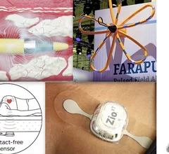 Top videos on the Cardiovascular Business website about new cardiovascular trends and technologies in 2024.