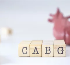 CABG coronary artery bypass grafting heart surgery