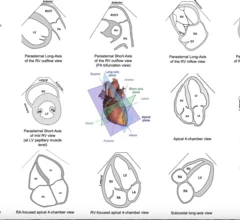 Standard transthoracic imaging planes for comprehensive right heart assessment. Several key views should be included in the standard echocardiographic assessment of the right heart. Image and caption courtesy of the American Society of Echocardiography.