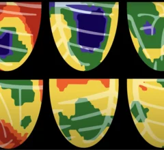 HeartSee 4.0 Bracco Diagnostics