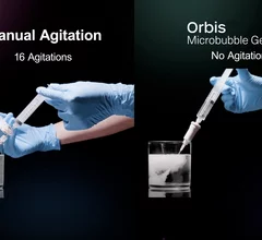 The Agitation Solutions Orbis Microbubble Generator simplifies and streamlines the process of saline agitation and delivery for cardiac bubble studies using a single use syringe. It is was cleared for use in Canada in 2024.
