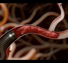 Perfuze Millipede 088 catheter