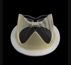 Foldax Tria mitral valve