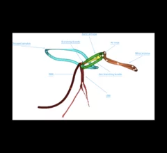 simulation of the conduction pathway relative to various cardiac structures.