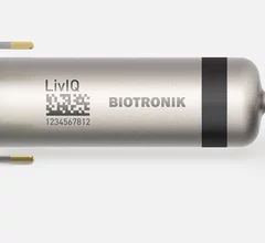  Biotronik's LivIQ leadless pacemaker offers a single-device solution designed to deliver atrioventricular (AV) synchrony through advanced electrical atrial far-field sensing. 