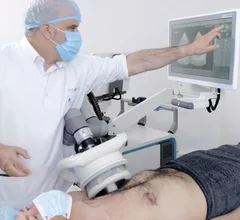 Cardiawave announced the first routine clinical use in Europe of its Valvosoft system since its CE mark regulator clearance in late 2025. It is a noninvasive, high-intensity ultrasound therapy to fragment leaflet calcium in severe symptomatic aortic stenosis, and I is aimed at patients who are not ideal for surgical or transcatheter aortic valve replacement, or who decline surgical intervention.