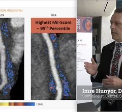 Imre Hunyor, DPhil (Oxon), MBBS (Hons), explained Central Sydney Cardiology’s clinical implementation of Christo's CaRi-Heart fat attenuation index (FAI) imaging technology. It is the first clinical implementation in Australia. The technology uses artificial intelligence (AI) to review coronary CT angiography (CCTA) scans for inflammation in the fat surrounding the arteries. This can add additional, specific information on a patient's risk for heart attacks otherwise is not detectable using current tech.