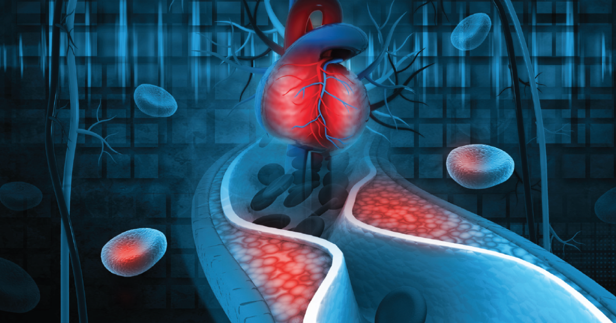 American College of Cardiology shares new guidance for treating ASCVD ...