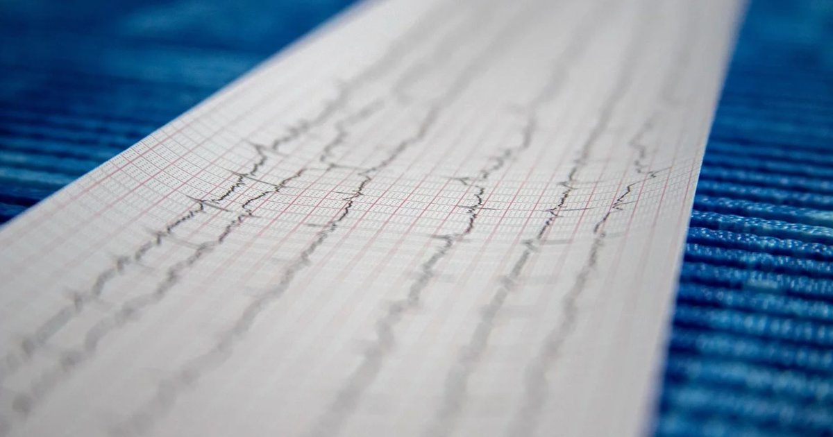 An alternative to pacemakers? Ablation method treats sinus bradycardia
