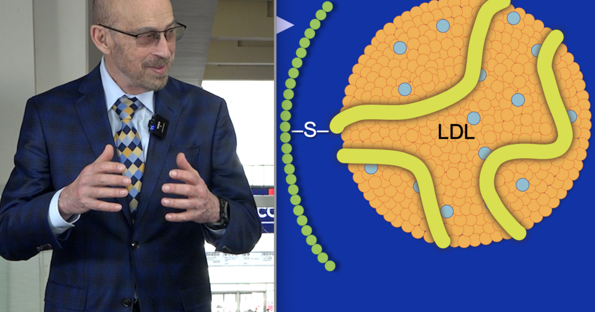 VIDEO: Use of mRNA drug to lower lipoprotein(a) by up to 98%