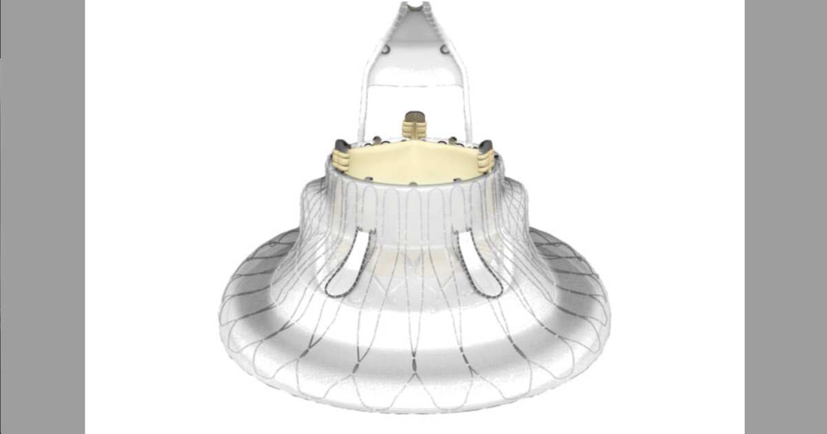 Cardiologists make history, perform TTVR with new-look valve for first ...