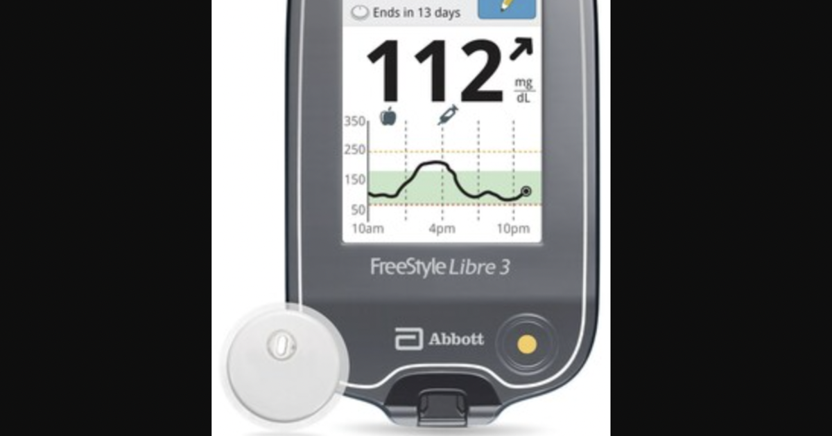 Abbott's Freestyle Libre glucose monitoring system, USA