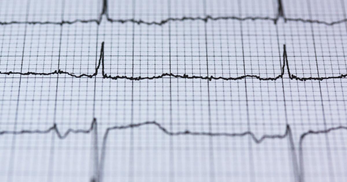 How Adderall affects the heart when you don’t have ADHD: a cardiologist’s warning