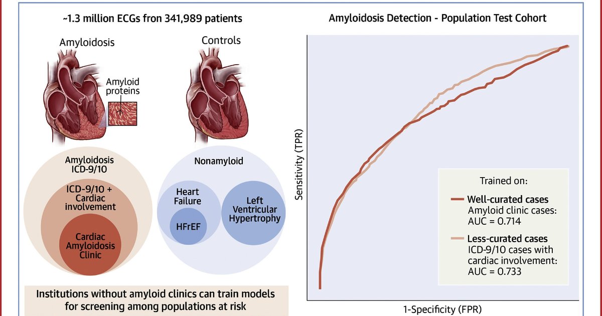 Read more about the article Using ECG AI to find the needle in the haystack of cardiac amyloidosis