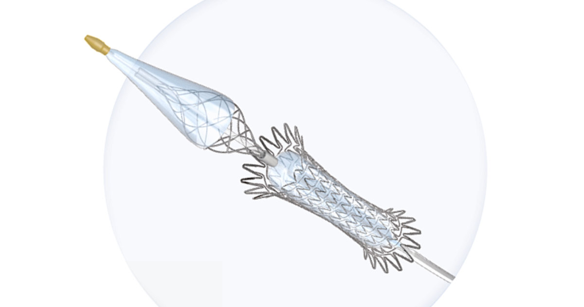 Medtronic expands carotid portfolio with Contego Medical deal