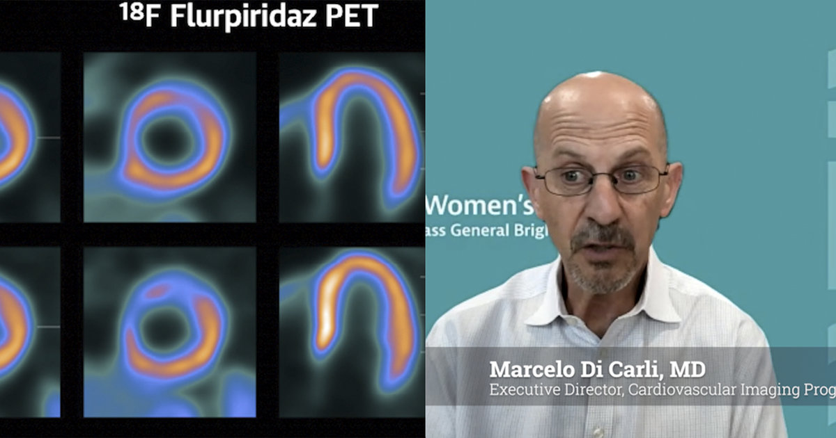 How PET is transforming cardiac nuclear imaging