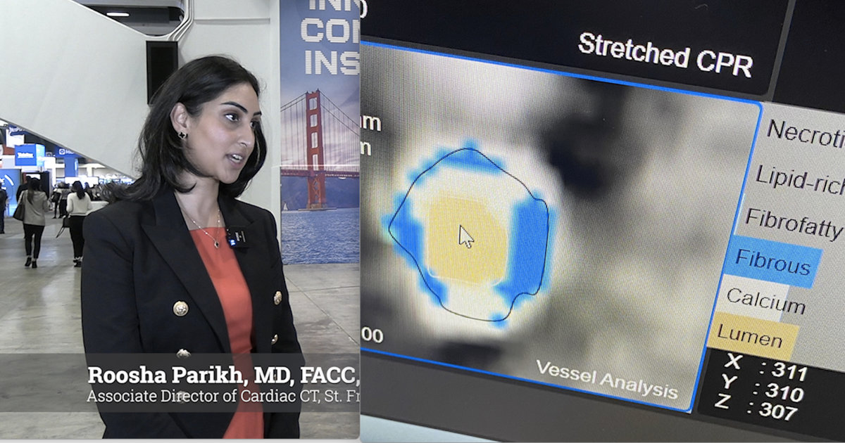 Reimbursement for AI-based plaque assessments is improving