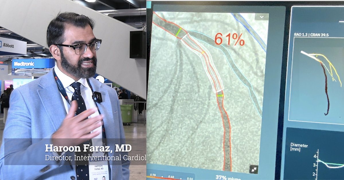 Haroon Lab New strategies for intravascular imaging and physiological assessments ...