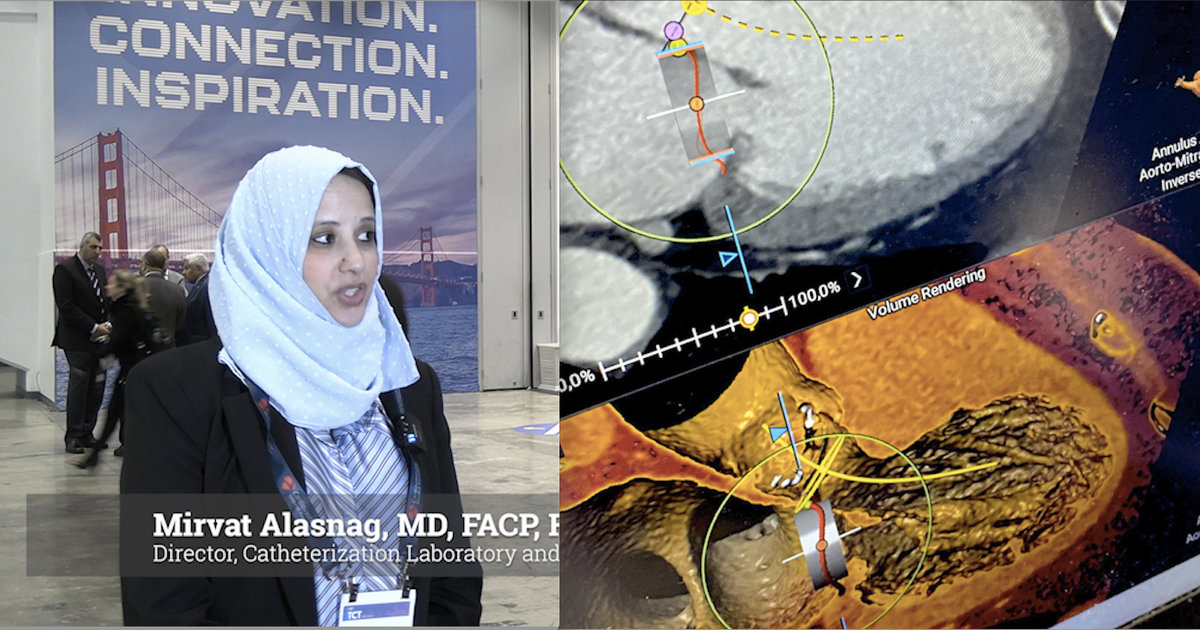 CCTA continues to transform cardiac imaging, interventional cardiology