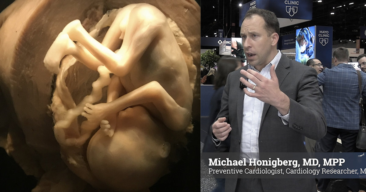 How hypertension during pregnancy impacts a woman’s long-term cardiovascular health