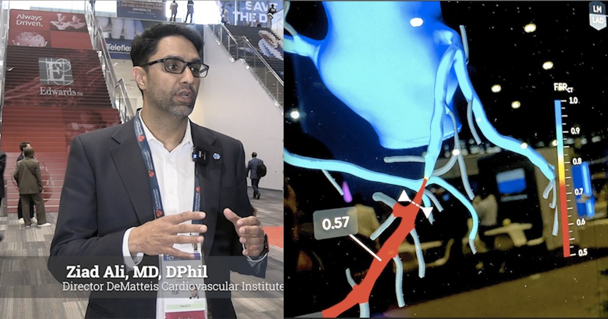 CCTA becoming an essential tool for interventional cardiologists