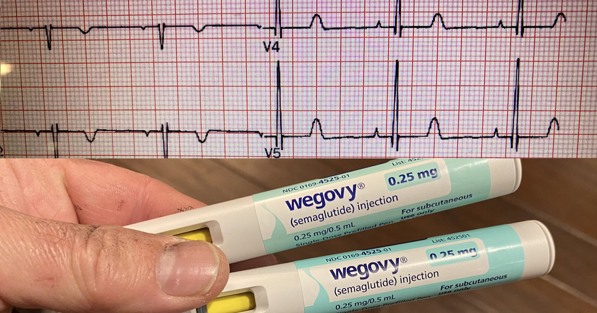 Multiple GLP-1 drugs linked to lower AFib risk