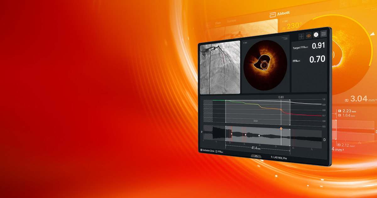 Abbott gains FDA clearance, CE mark approval for AI-powered imaging platform