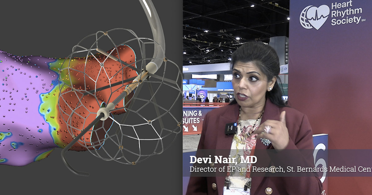 PFA has been a game-changer for heart patients—but there are still risks
